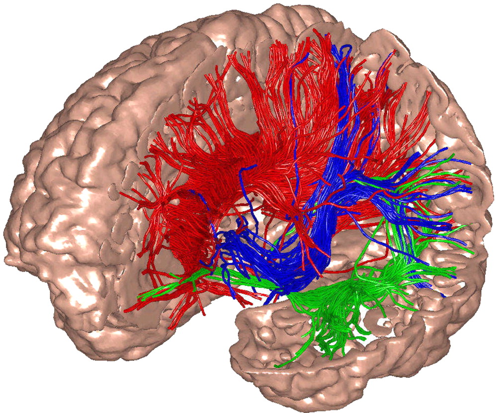Fibras blancas del sistema talamo-cortical